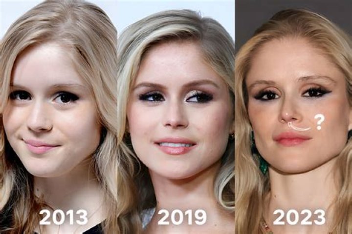 Erin Moriarty Chirurgie